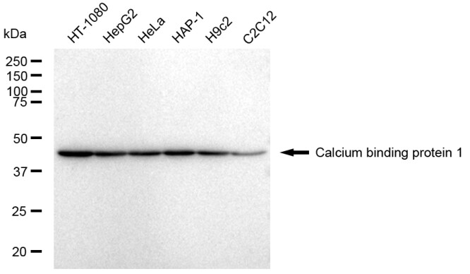 CABP1 Antibody (23GB4365)