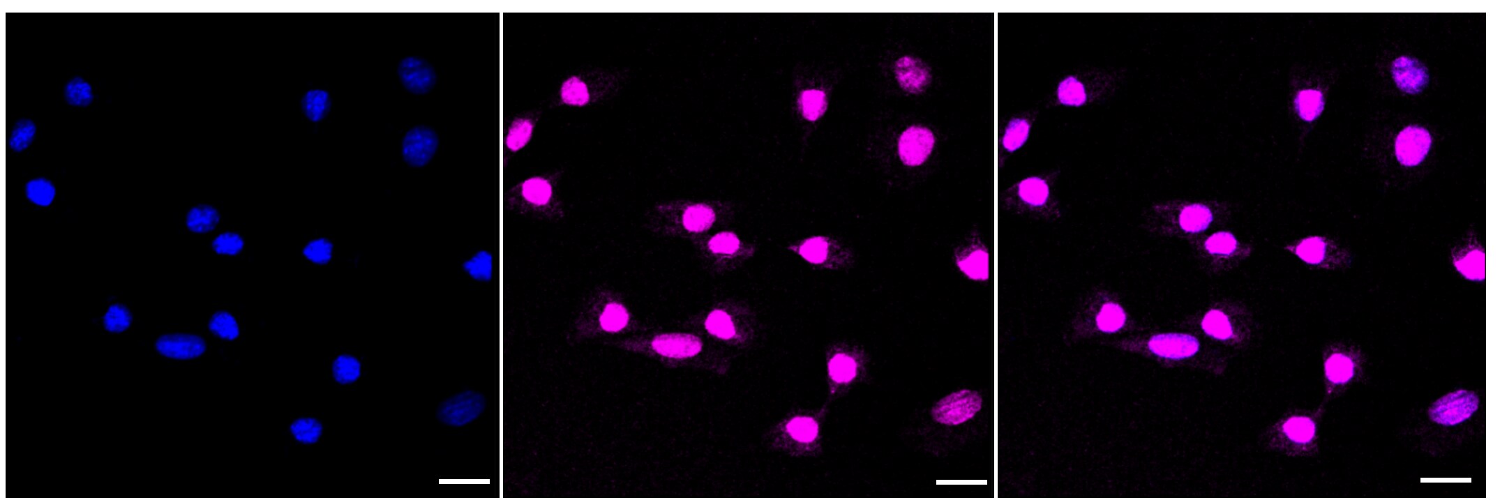 Histone H3 [Monomethyl Arg17] Antibody (23GB4400)