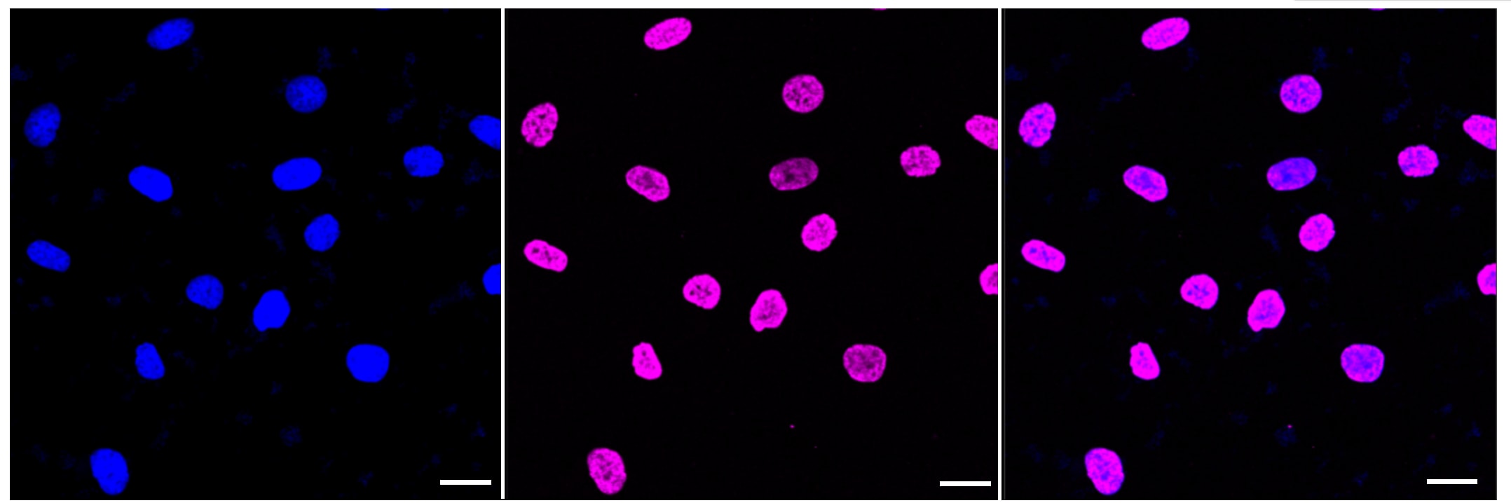 Histone H3 [ac Lys14] Antibody (23GB4405)
