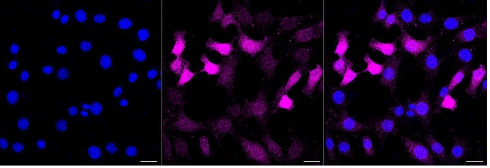 Histone H3 [Monomethyl Arg2] Antibody (23GB4415)