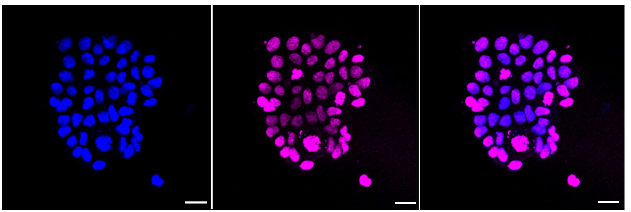 Histone H3 [Dimethyl Lys9] Antibody (23GB4420)