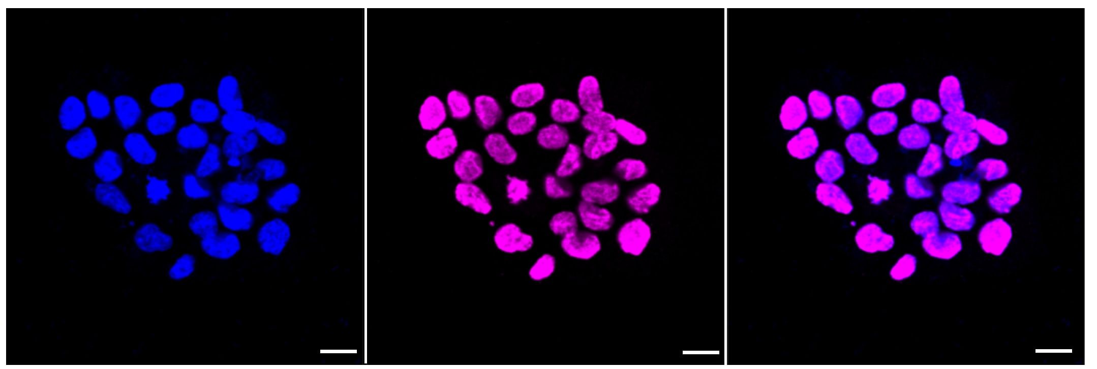 Histone H3 [ac Lys36] Antibody (23GB4425)