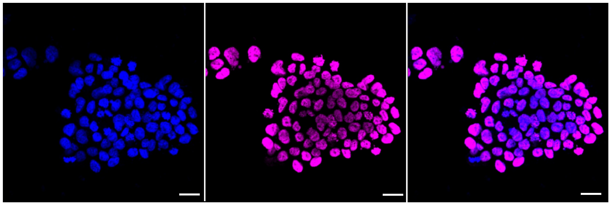 Histone H3 [ac Lys9] Antibody (23GB4445)