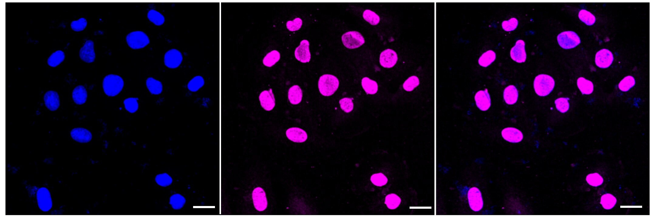 Histone H3 [Monomethyl Lys9] Antibody (23GB4450)