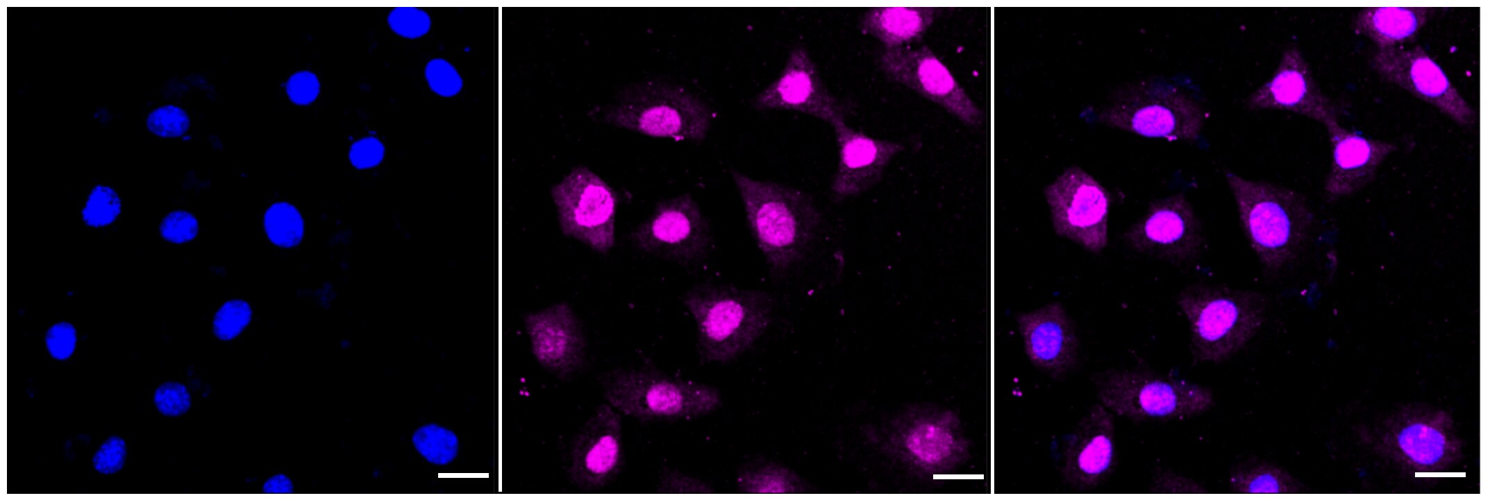 Histone H3 [Monomethyl Lys14] Antibody (23GB4455)