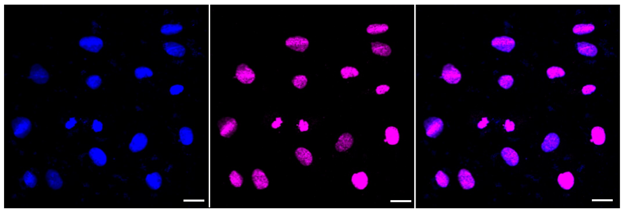 Histone H3 [Trimethyl Lys27] Antibody (23GB4470)