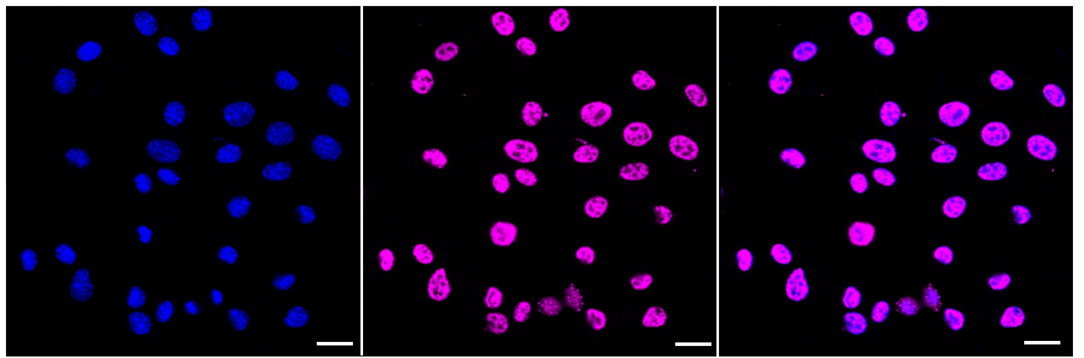 c-Jun/JunD [p Ser73] Antibody (23GB4495)