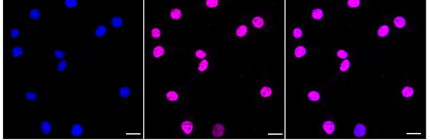 BCKDK Antibody (24GB3065)