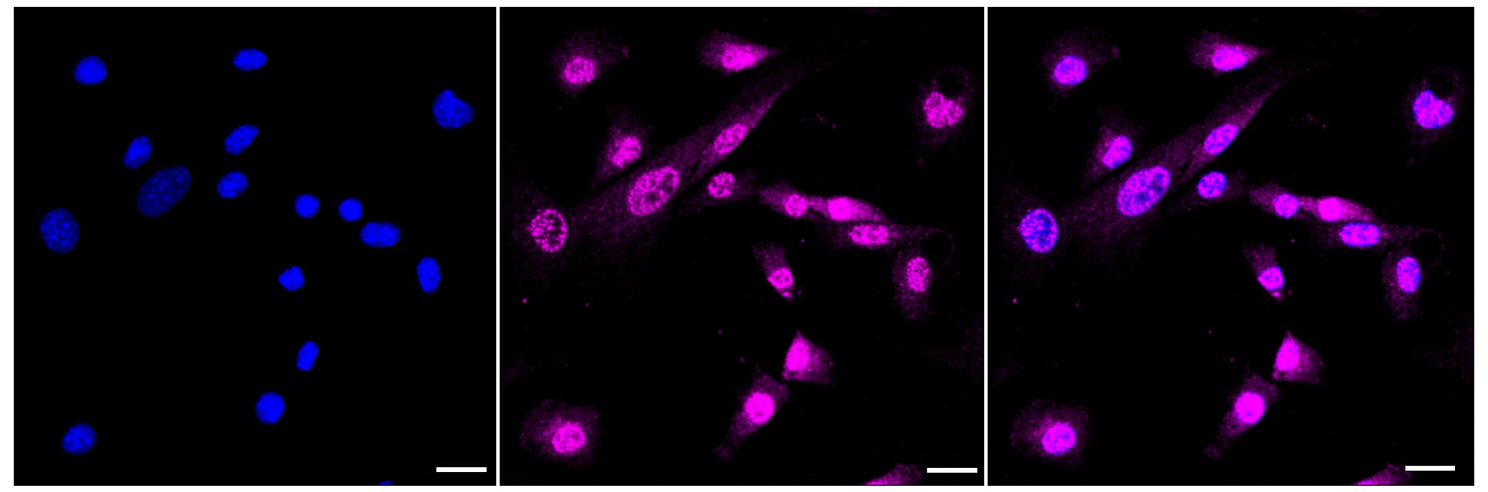 ERK1/ERK2 [p Thr202] Antibody (23GB4515)