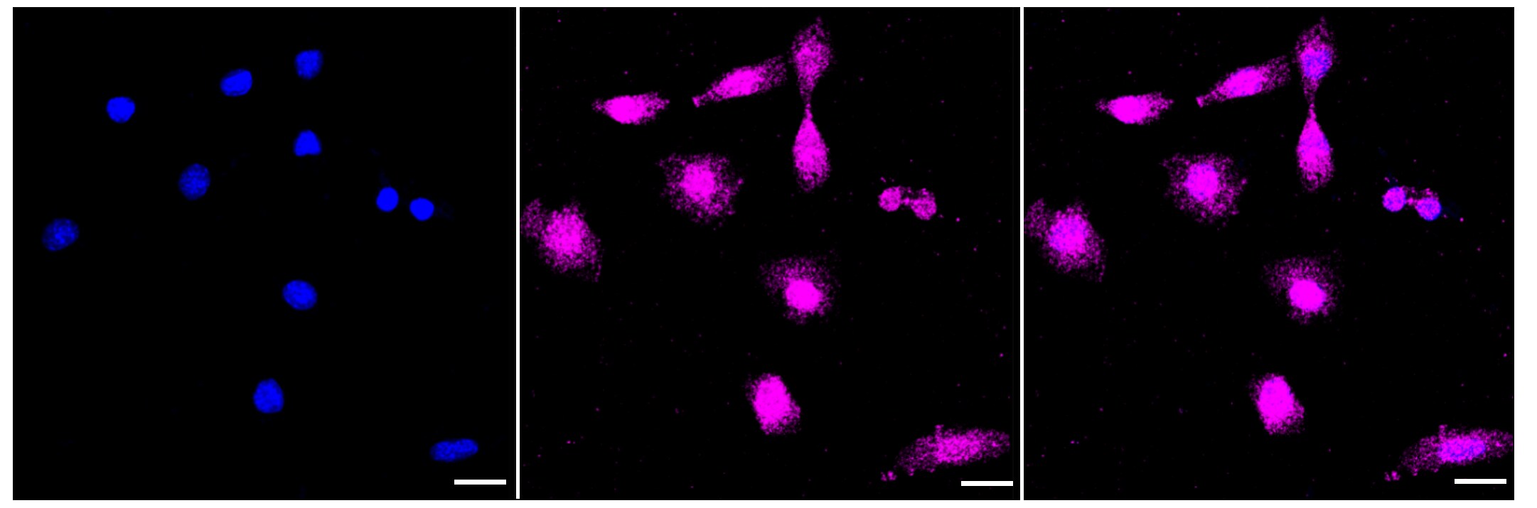 ERK1/ERK2 [p Thr204] Antibody (23GB4520)