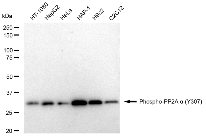 PP2A alpha [p Tyr307] Antibody (23GB4580)