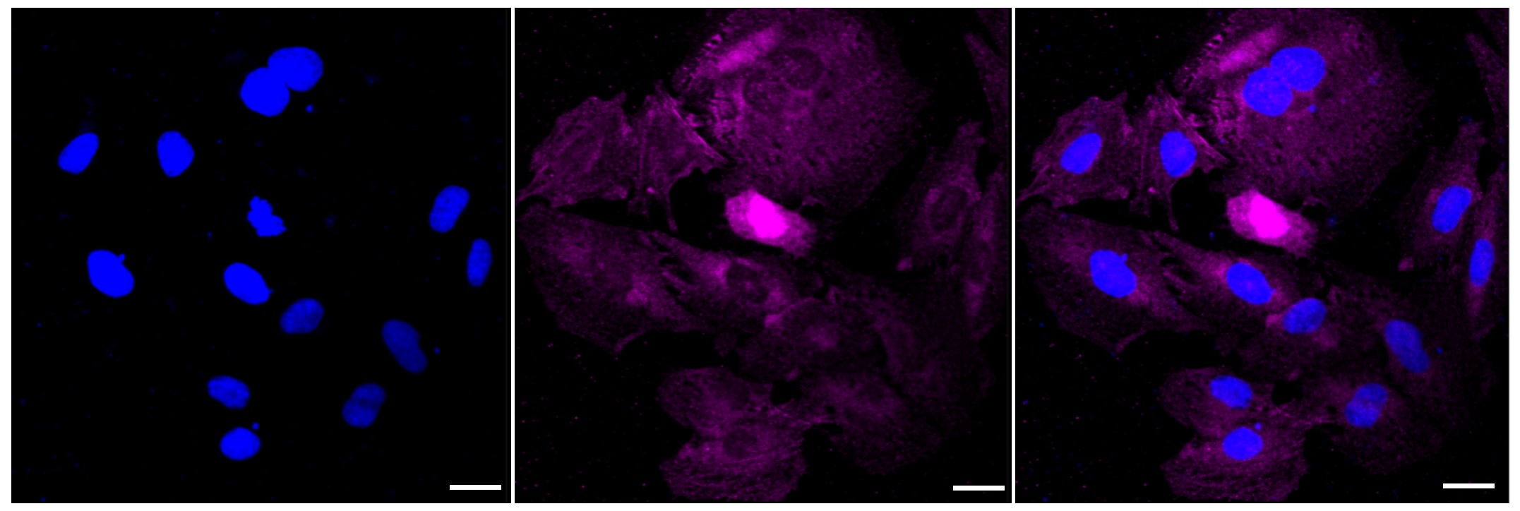 PKC mu Antibody (23GB4590)