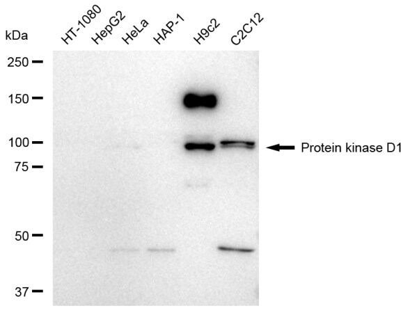 PKC mu Antibody (23GB4590)
