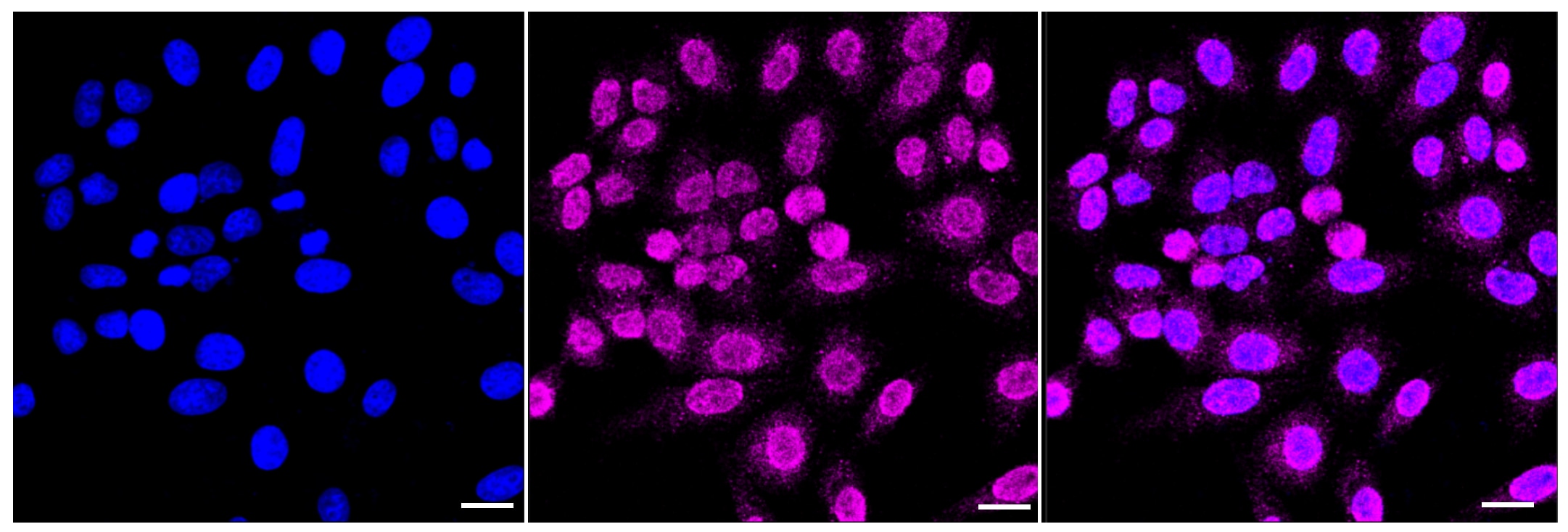 RASSF2 Antibody (23GB4605)