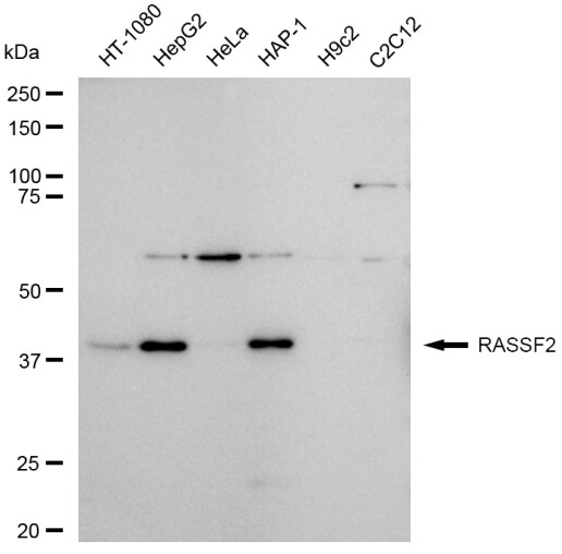 RASSF2 Antibody (23GB4605)