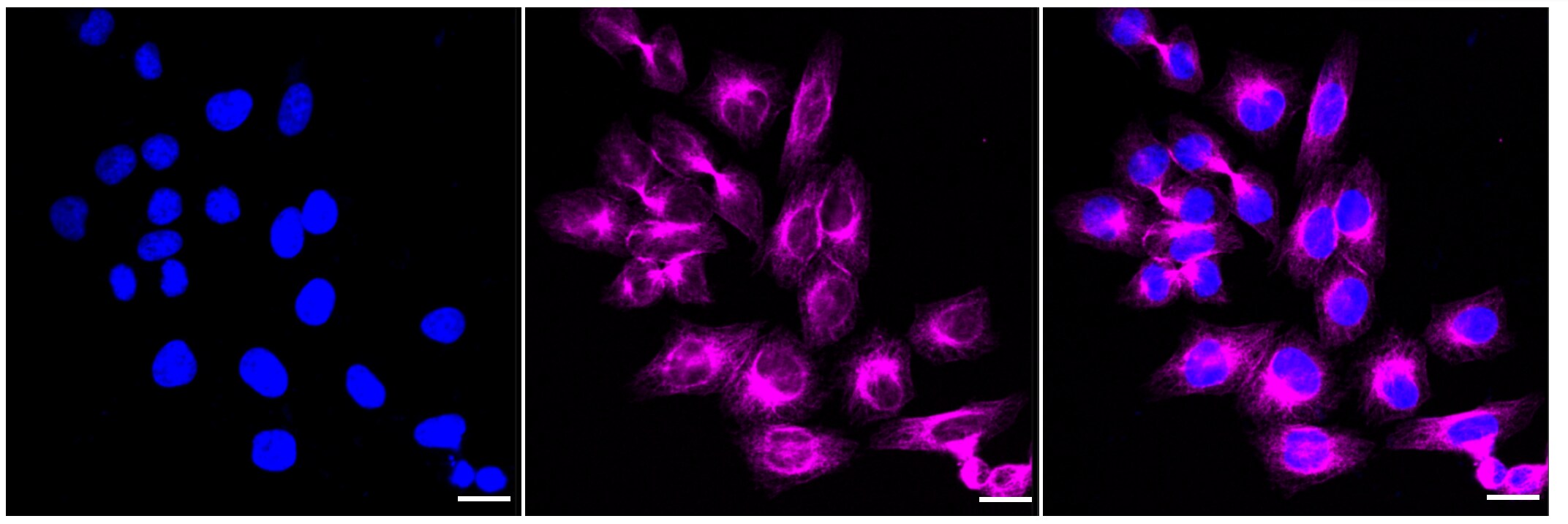 ARA54 Antibody (23GB4610)