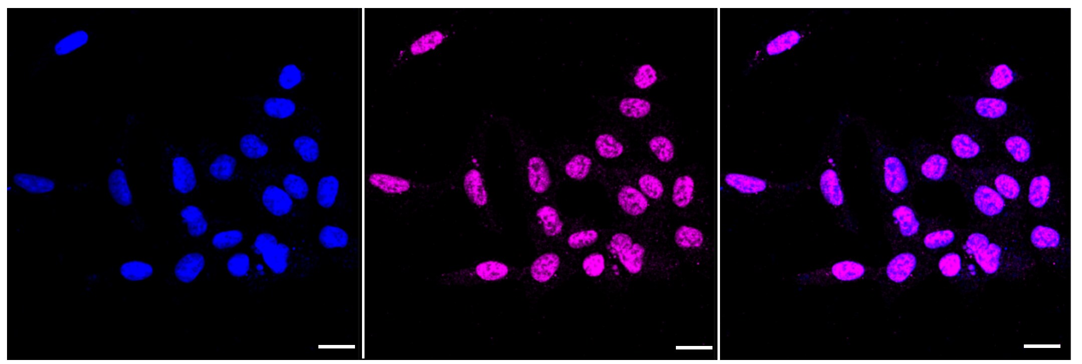 KAP1 [p Ser824] Antibody (23GB4700)