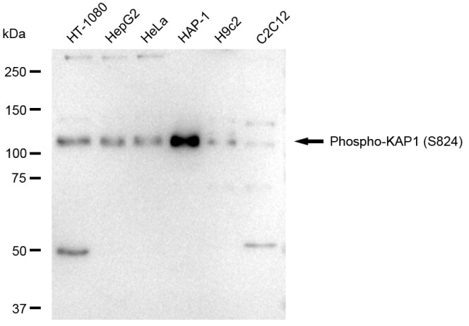 KAP1 [p Ser824] Antibody (23GB4700)