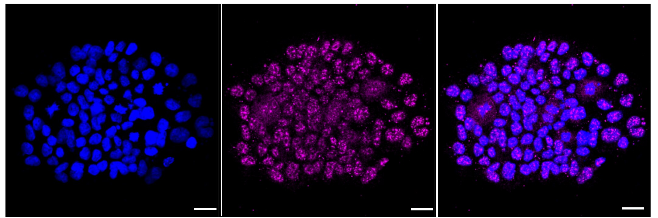 AMPK alpha 2 [p Ser491] Antibody (23GB5675)