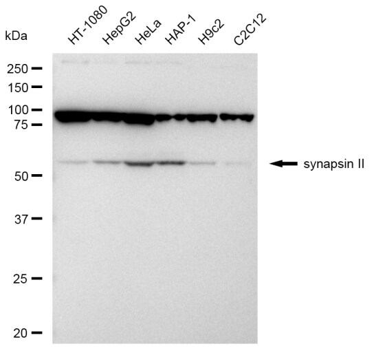 Synapsin II Antibody (23GB4960)