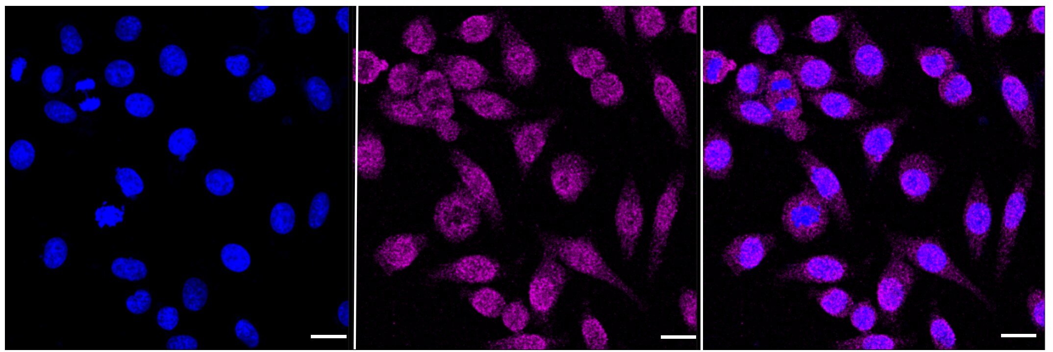 14-3-3 zeta/beta Antibody (23GB4830)