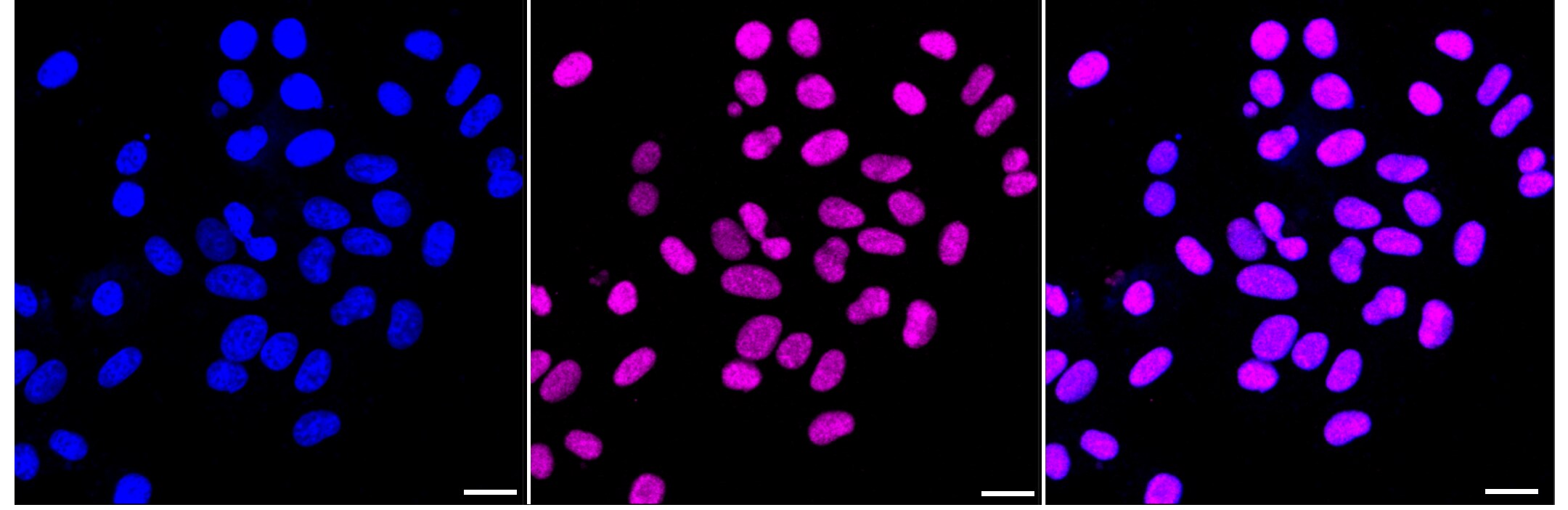 YY1 Antibody (23GB4790)