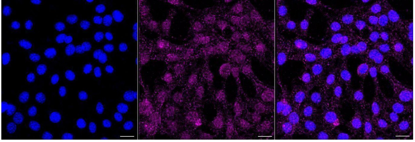 BTK [p Tyr223] Antibody (23GB4815)