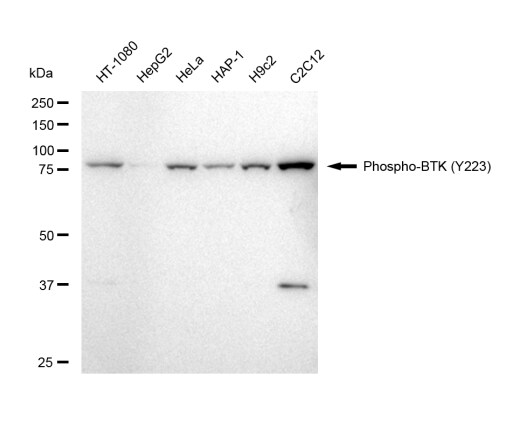 BTK [p Tyr223] Antibody (23GB4815)