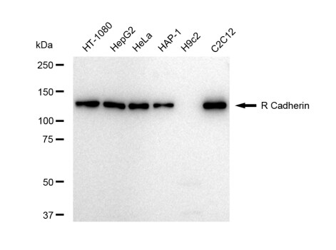 Cadherin-4/R-Cadherin Antibody (23GB5055)