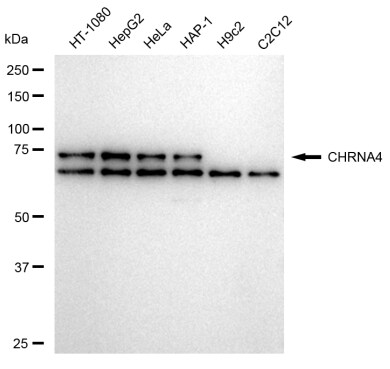 Nicotinic Acetylcholine R alpha 4/CHRNA4 Antibody (23GB5085)