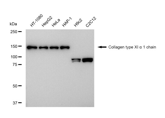 COL11A1 Antibody (23GB5100)
