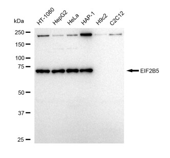 eIF2B epsilon Antibody (23GB5300)