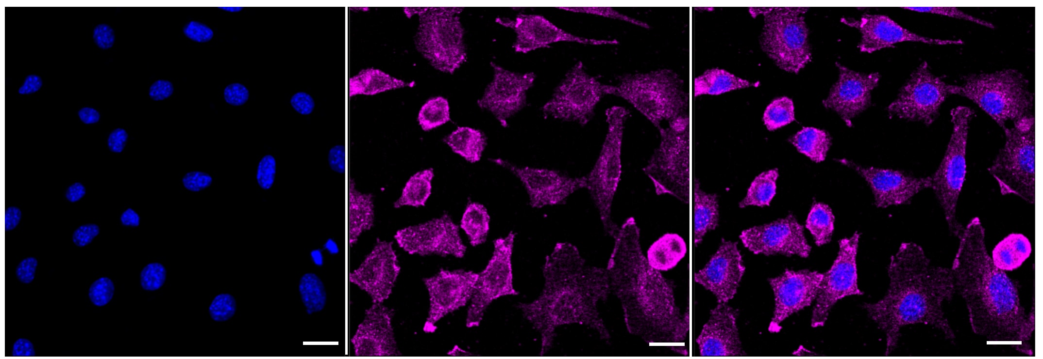 Elp3 Antibody (23GB5305)