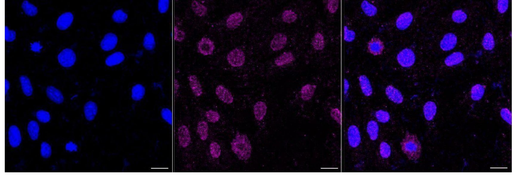 CD39L4/ENTPD5 Antibody (23GB5330)