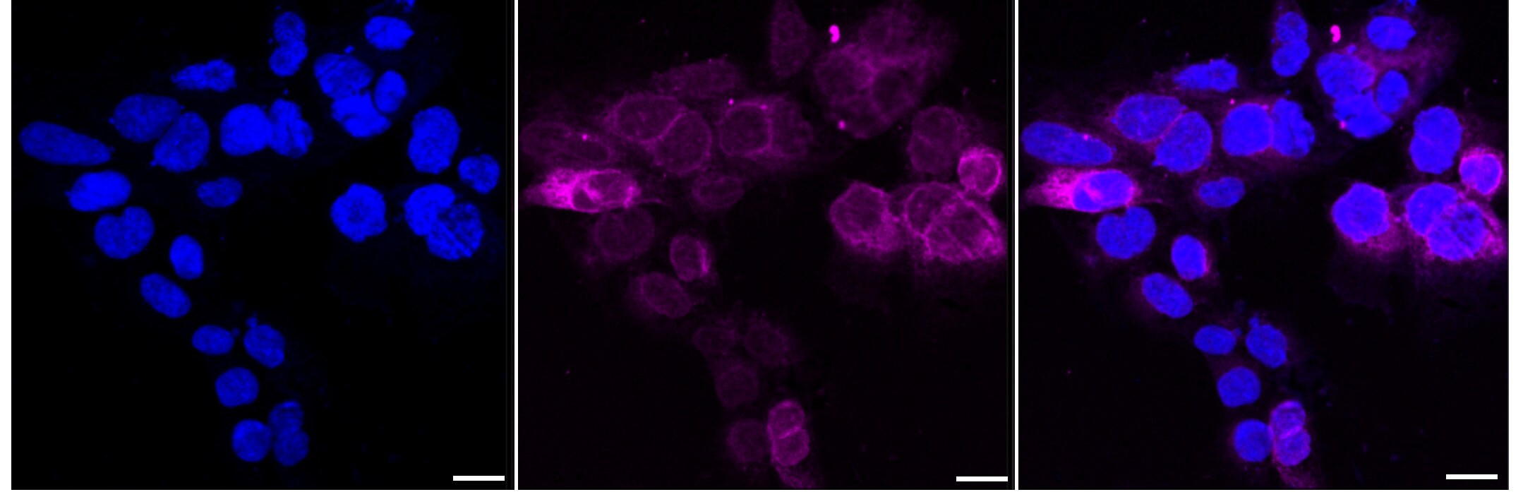 FDFT1 Antibody (23GB5390)