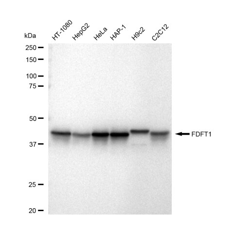 FDFT1 Antibody (23GB5390)