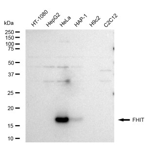 FHIT Antibody (23GB5415)