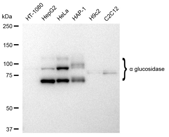 LYAG/GAA Antibody (23GB5480)