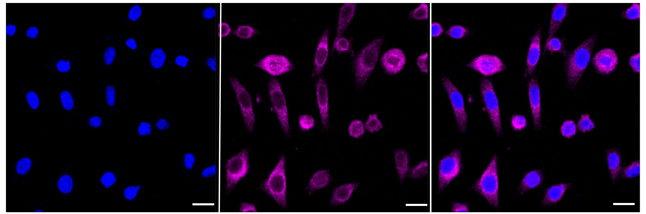 Histone H3 [Dimethyl Lys79, Trimethyl Lys79, Monomethyl Lys79] Antibody (23GB5000)