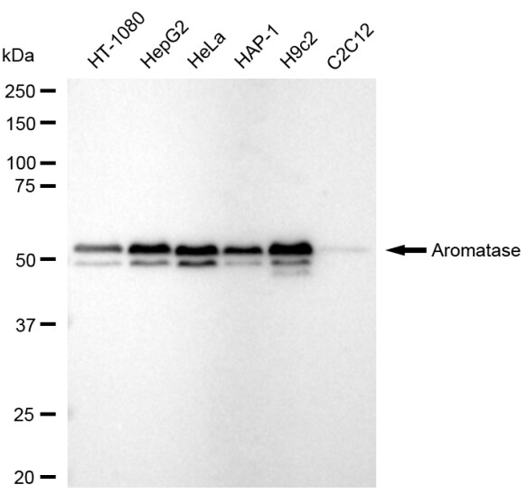 Aromatase Antibody (23GB5770)