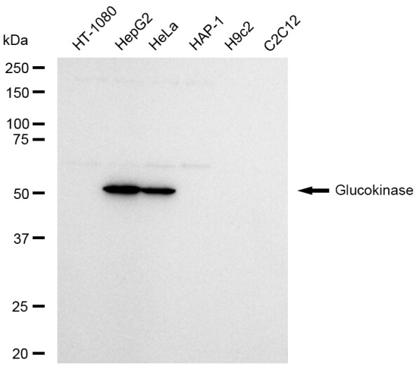Glucokinase/GCK Antibody (23GB5845)