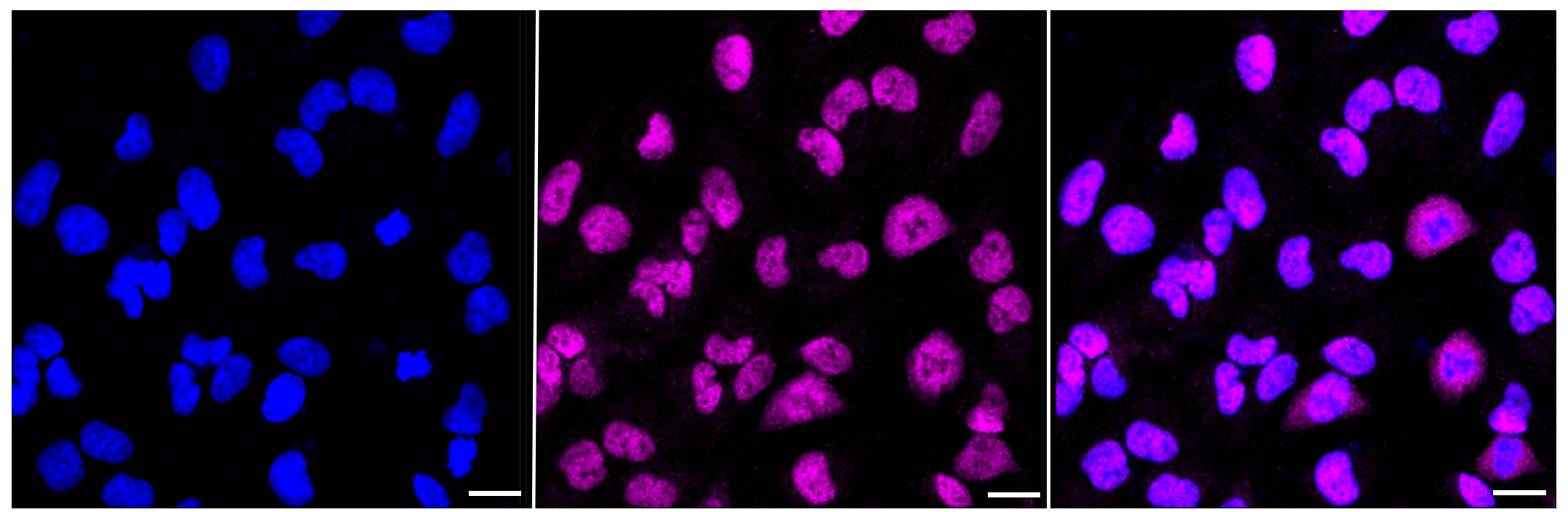 FKBP51/FKBP5 Antibody (23GB5880)