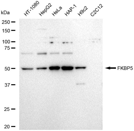 FKBP51/FKBP5 Antibody (23GB5880)