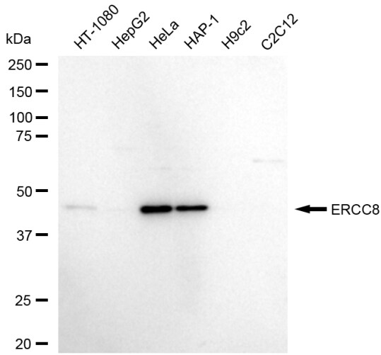 ERCC8 Antibody (23GB5905)
