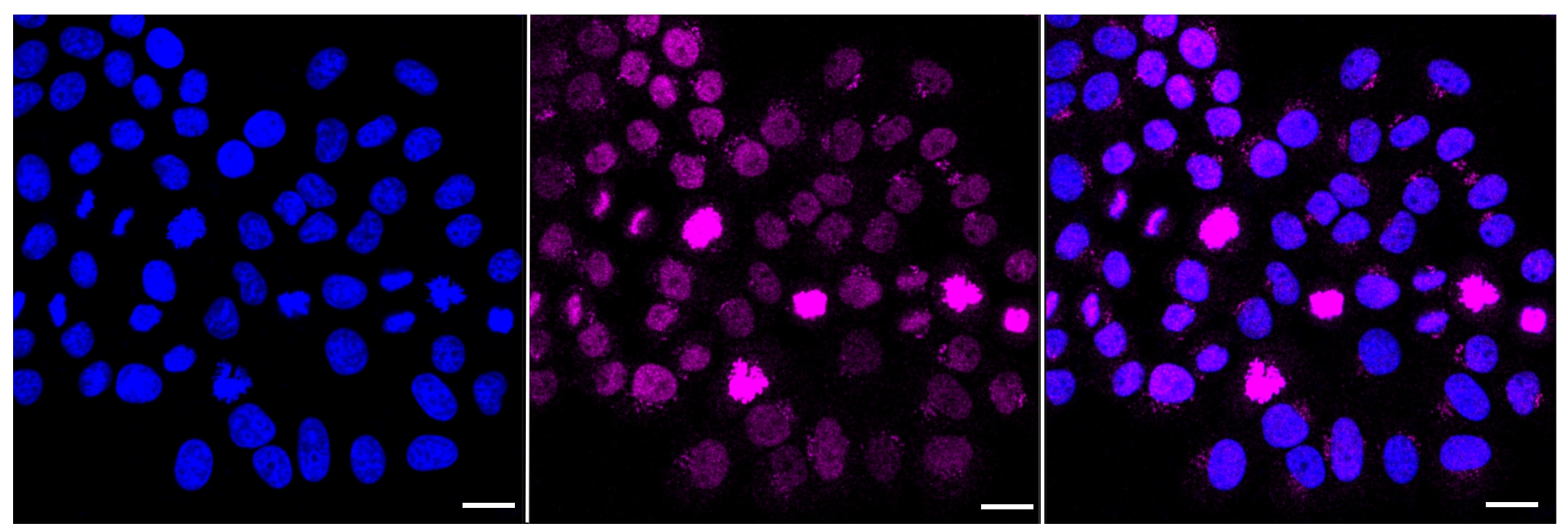 Histone H3.3 [p Ser31] Antibody (23GB6015)