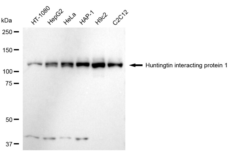 HIP1 Antibody (23GB6020)