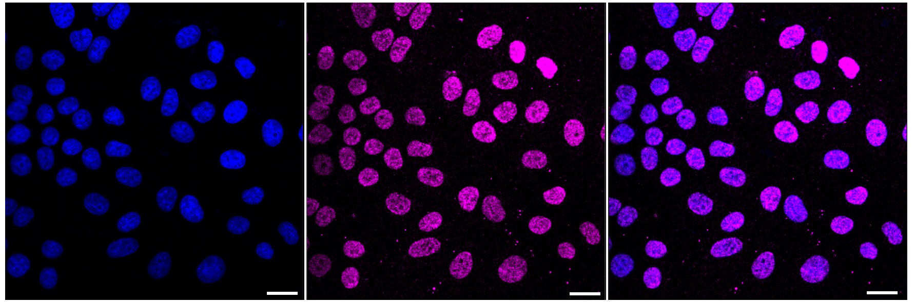 Histone H4 [ac Lys16] Antibody (23GB6045)