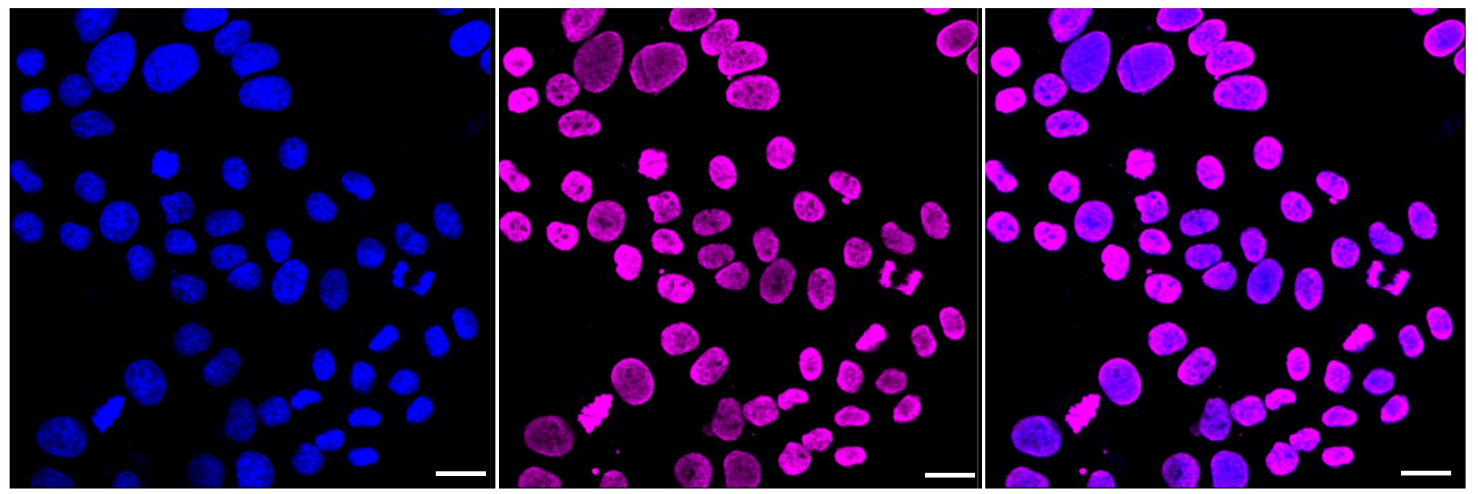 Histone H4 [ac Lys5] Antibody (23GB6055)