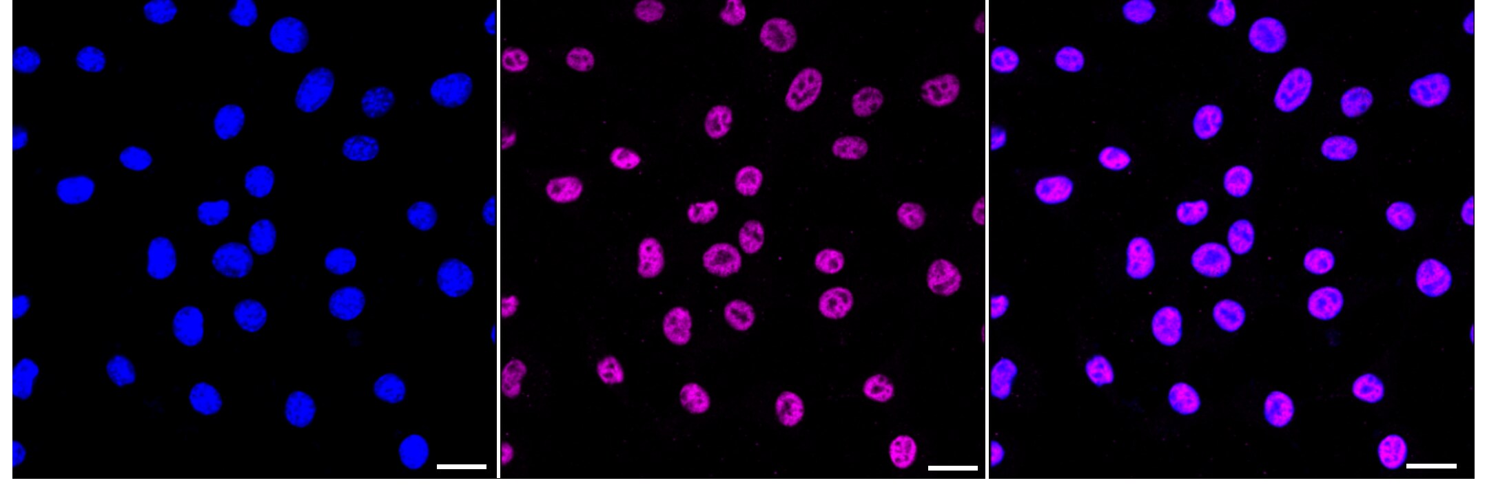 Histone H2a [ac Lys9] Antibody (23GB6080)