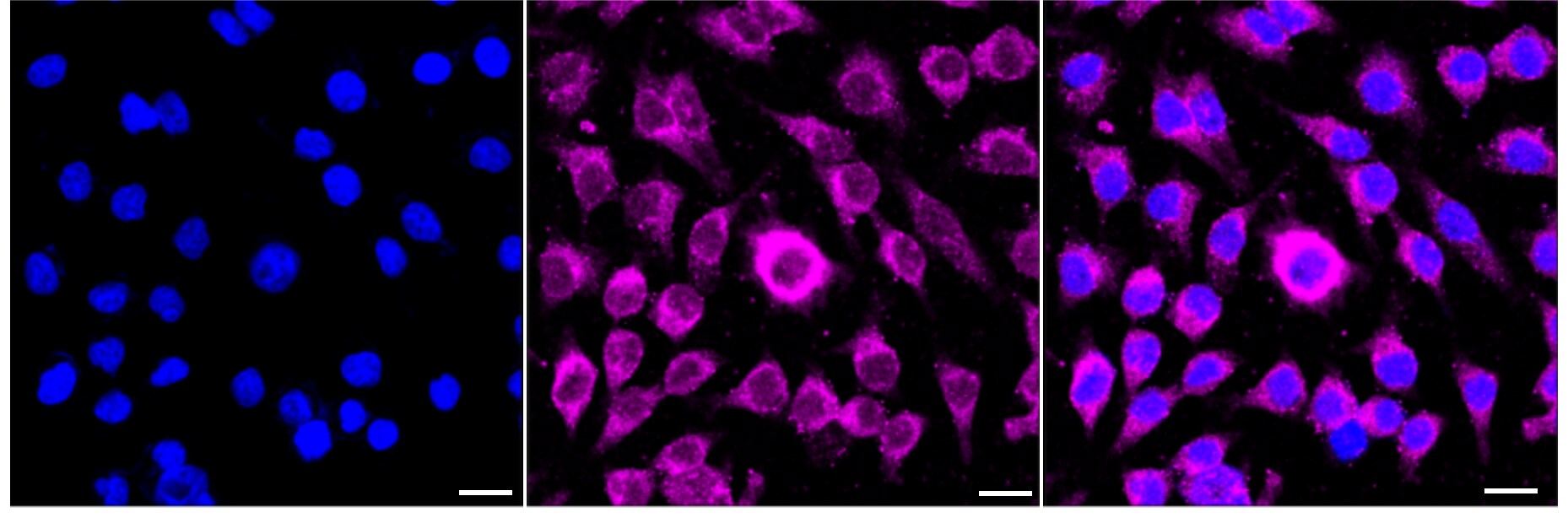 ROCK1 Antibody (24GB5310)